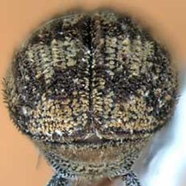             Hylesinus criddlei , posterior view   (declivity)   