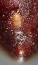  lens and hilum of seed 