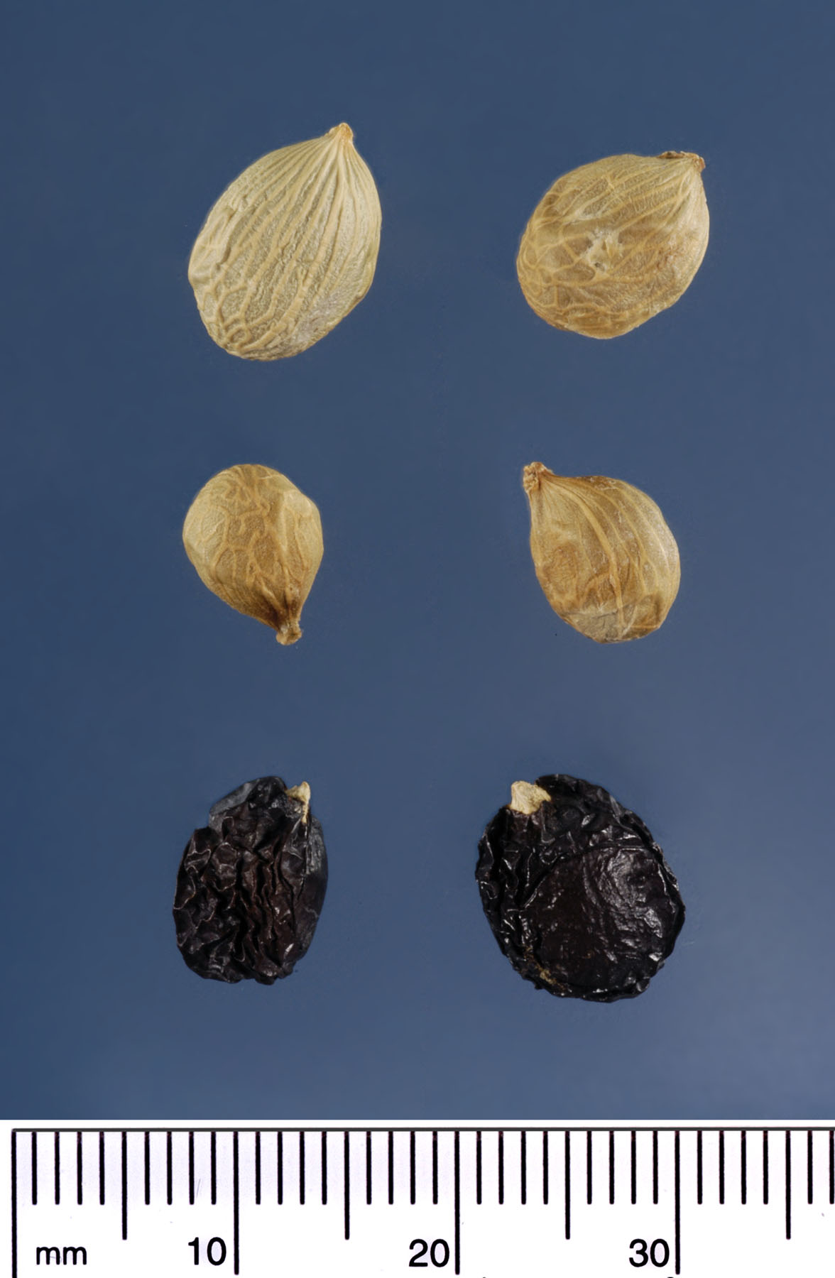   Chamaedorea metallica  seeds (above) dried fruits (below). Photograph courtesy of Mariana P. Beckman, DPI 