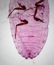  Mealybug ( Ferrisia terani ) slide-mounted female, ventral view of abdomen; photo by P. Johnson, USDA APHIS PPQ  
