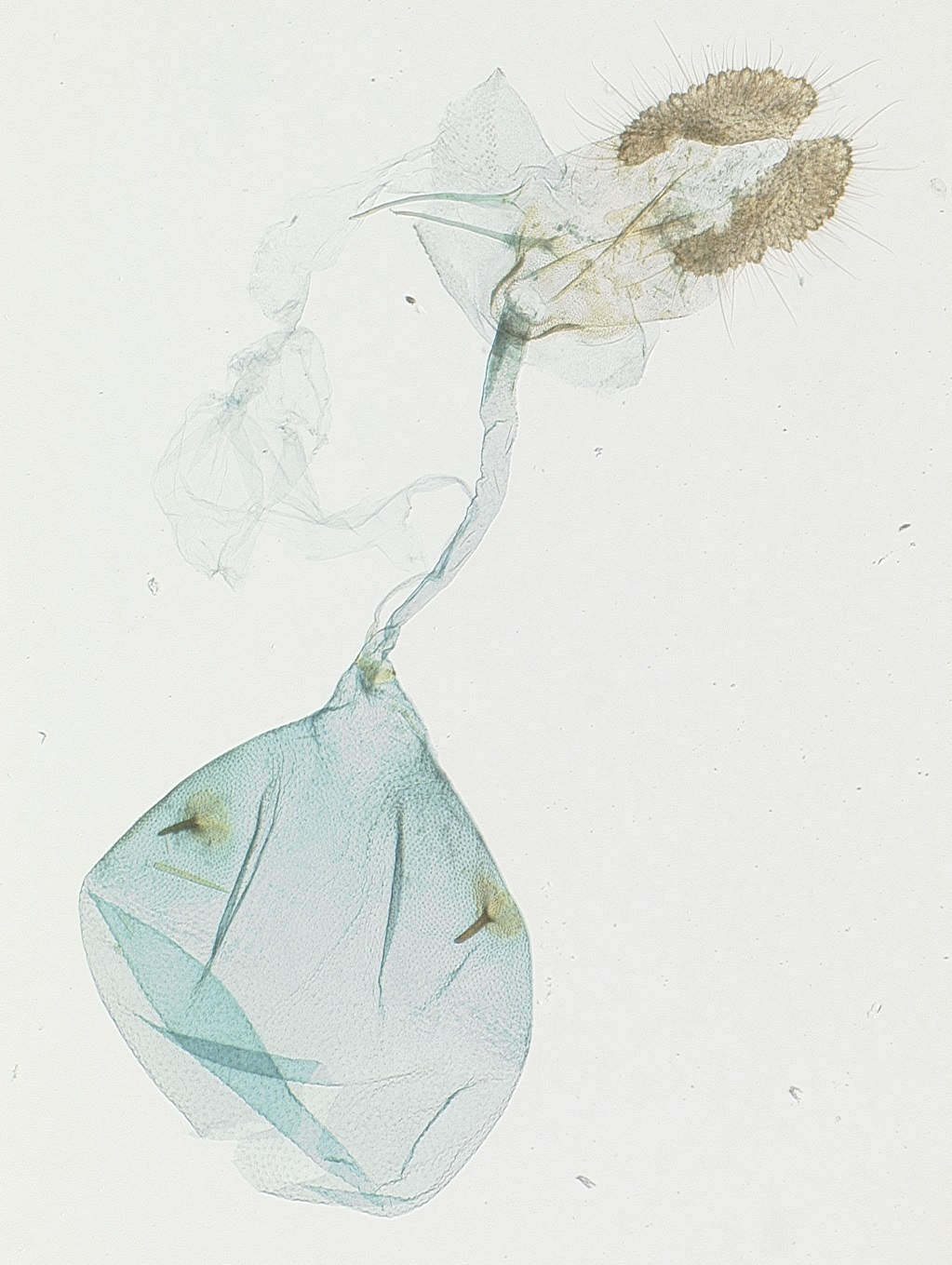 Female genitalia. © James Hayden, FDACS-DPI. Image used with permission.