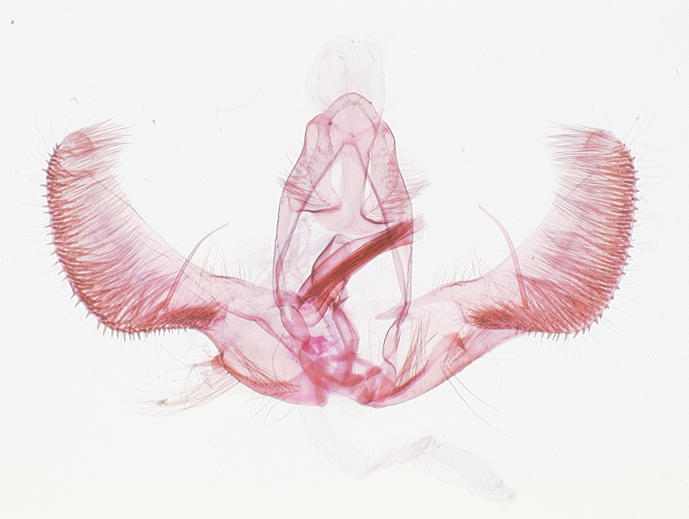 Male genitalia. © James Hayden, FDACS-DPI. Image used with permission.