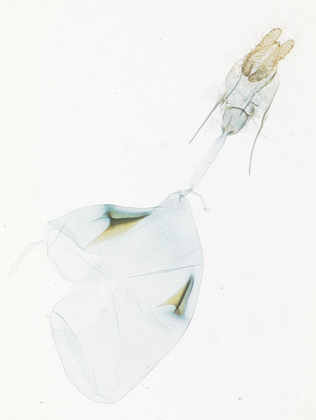 Female genitalia. © James Hayden, FDACS-DPI. Image used with permission.