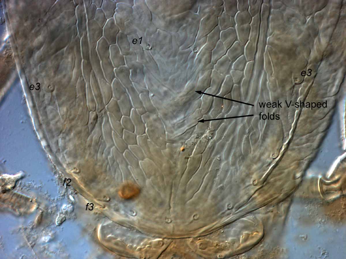  Fig. 7.  Brevipalpus californicus  sensu stricto, female posterior dorsal opisthosoma (holotype specimen). 