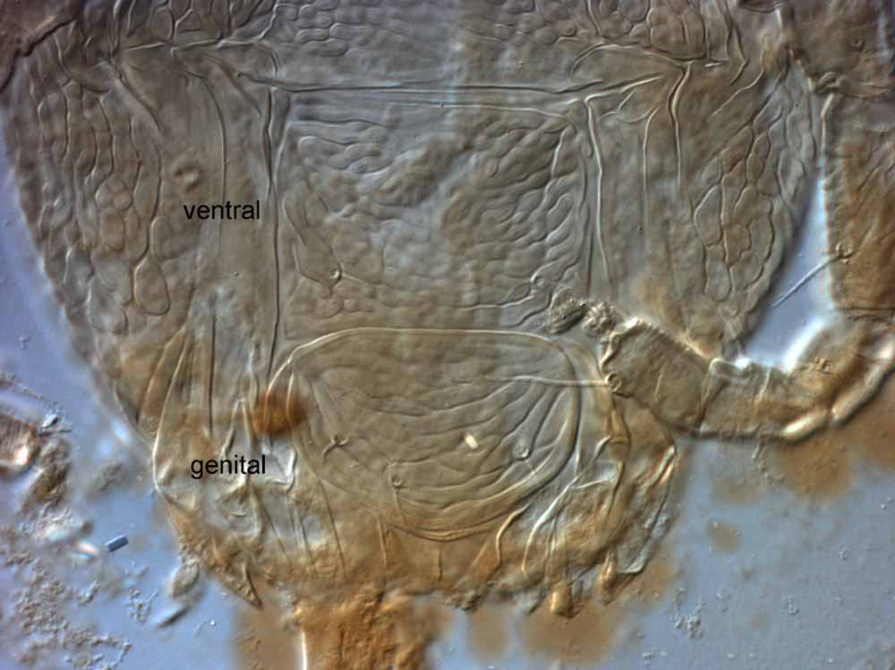  Fig. 9.  Brevipalpus californicus  sensu stricto, female posterior venter (holotype specimen). 