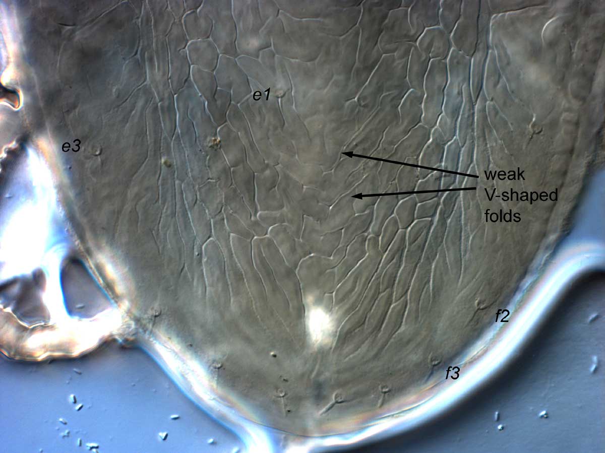  Fig. 8.  Brevipalpus californicus  sensu stricto, female posterior dorsal opisthosoma (paratype specimen). 