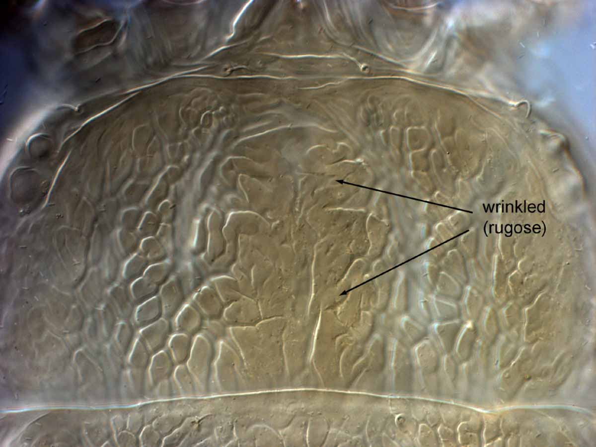 Fig. 5.  Brevipalpus californicus  sensu stricto, female prodorsum (paratype specimen). 