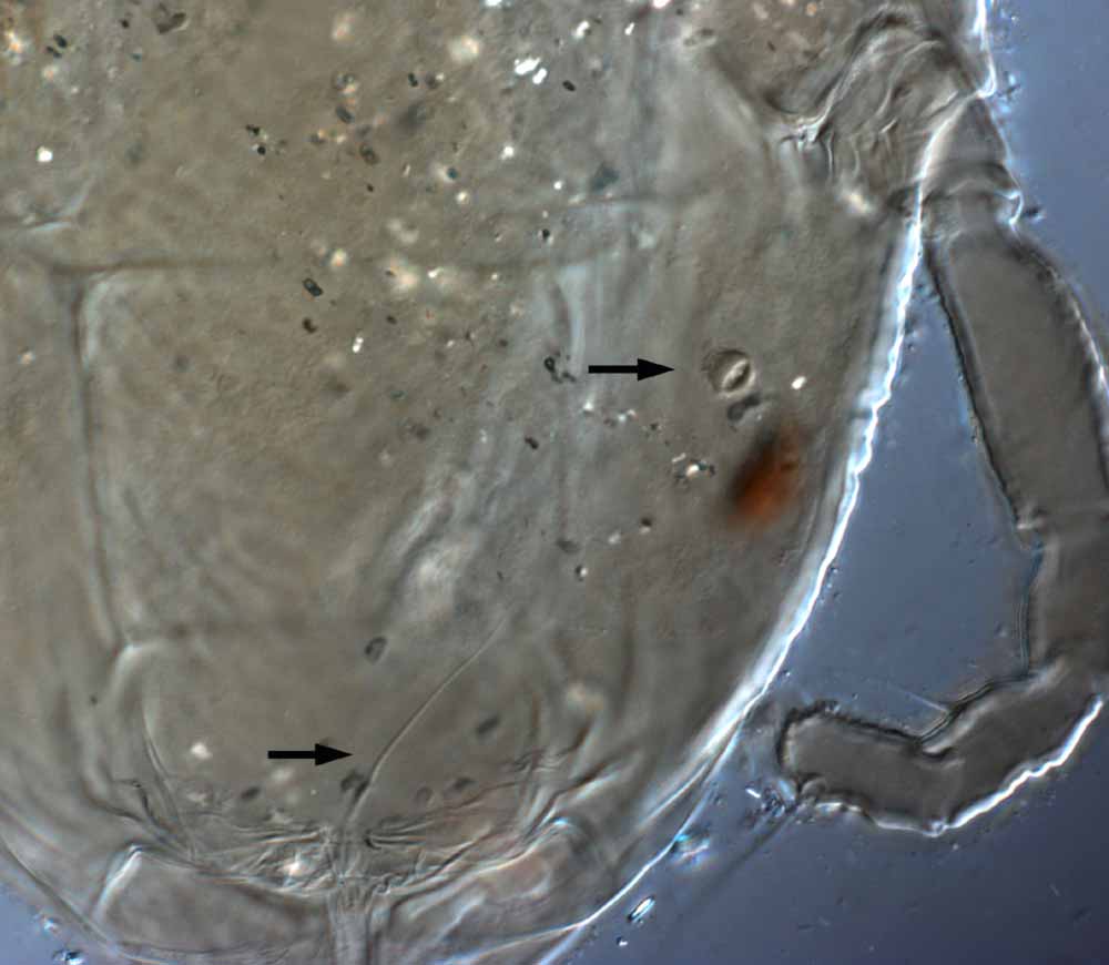  Fig. 13.  Brevipalpus californicus  sensu stricto, female posterior opisthosoma indicating spermatheca and duct (see arrows) (paratype specimen). 