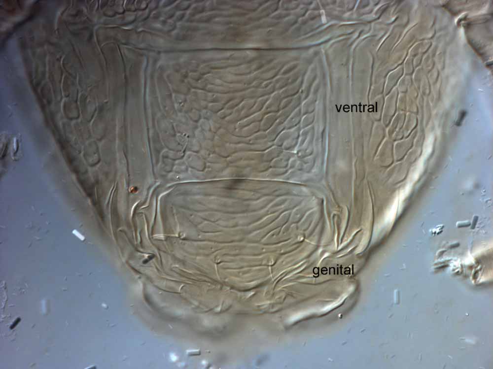  Fig. 11.  Brevipalpus californicus  sensu stricto, female posterior venter (paratype specimen). 
