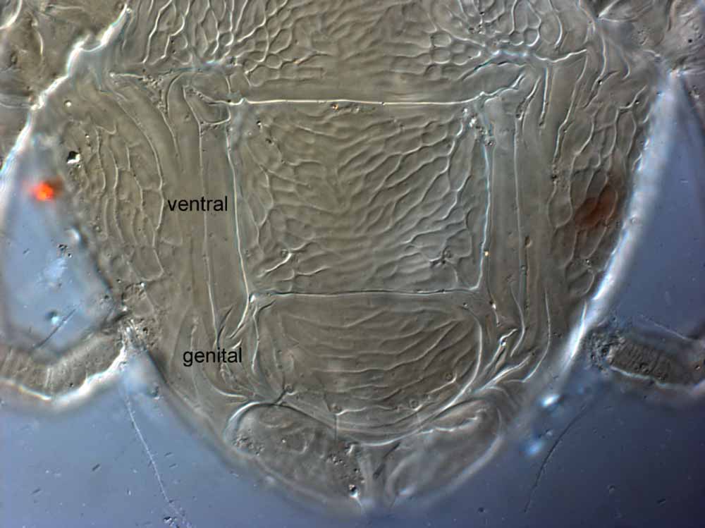  Fig. 10.  Brevipalpus californicus  sensu stricto, female posterior venter (paratype specimen). 