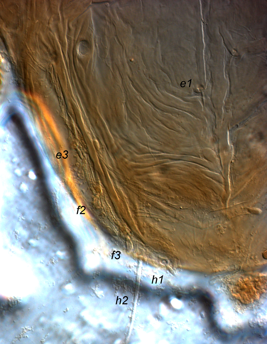  Fig. 3.  Tenuipalpus crassulus  female posterior dorsum, indicating lateral setae.

