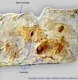   Acarapis woodi  in a trachea of the European honey bee,  Apis mellifera ; photo by Barry OConnor, University of Michigan.
