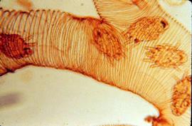  Tracheal mites in worker bee trachea; photo by I. Barton Smith, USDA
