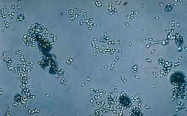   Nosema  spores (1000X); photo by The BeeMD photo collection
