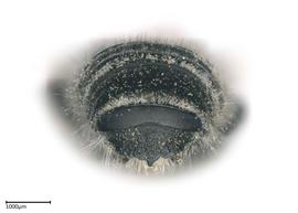   Megachilenbsp;manifesta nbsp;male apical terga, photo: Colleen Meidt 
