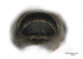   Pseudomegachilenbsp;ericetorum nbsp;male apical terga, photo: Joshua Hengel 
