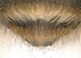   Osmia excavata  male, dorsal view of seventh tergum (T7), photo: Chelsey Ritner 
