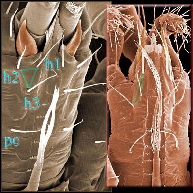 Feature page: Hypostomal setal alignment | Invasive Mite ID