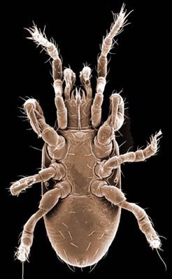 Figure 9; Athiasella male venter.