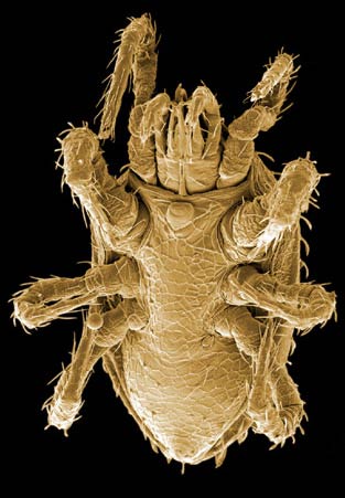 Figure 13; Stratiolaelaps male venter.
