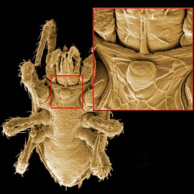 Figure 3; Tritosternum.