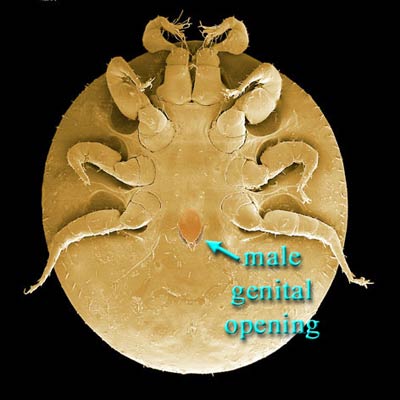 Figure 2; Male intercoxal genital opening.