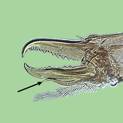 Fig. 3 finger-like process