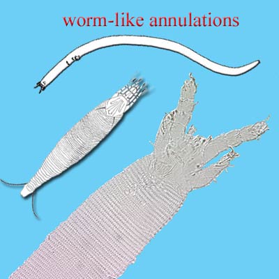 Figure 3: Gordialycus