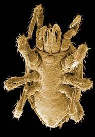  Stratiolaelaps  male venter