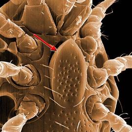 Sternal setae ( st1 – 5 ) on ventral shield that encompasses the genital opening and protects all of the venter
