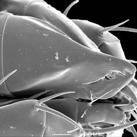 Acarid chelicerae (DEW)