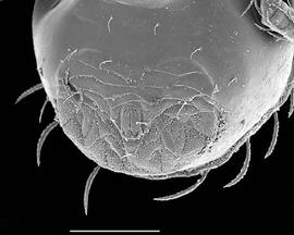   Ameroseius  ventrianal shield (DEW)
