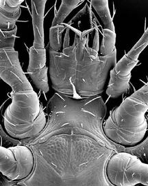 Diplogyniid female sternogenital region
