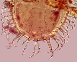  Gamasellus  soil layer removed (DEW)