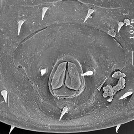  Evimirus  anal shield (DEW)