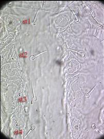 Halolaelapid sternal region (DEW)