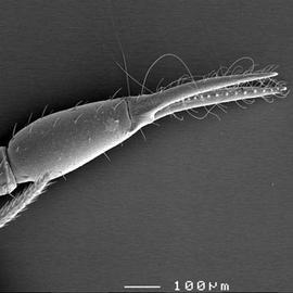 Chela (pedipalp) of pseudoscorpion (DEW)
