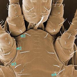  Proctolaelaps  sternal shield