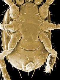  Proctolaelaps  female venter