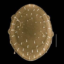  Uropodid from ant colony (DEW)
