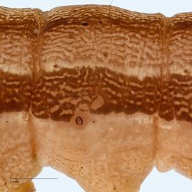 Fig. 8: Abdomen