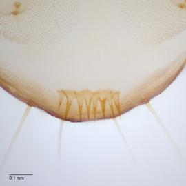Fig. 4: Anal comb