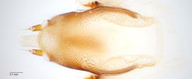 Fig. 9: Hypopharyngeal complex, dorsal view