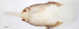 Fig. 10: Hypopharyngeal complex, lateral view
