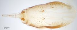 Fig. 12: Hypopharyngeal complex, dorsal view