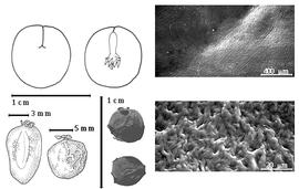  Seed, cotyledon, embryo, and testa:  A. jupunba  (C.L. von Willdenow) Britton & E.P. Killip - bottom left center seed topography, top left cotyledon concealing radicle (L) and embryonic axis (R), bottom center seeds, testa SEMs;  A. jupunba  (C.L. von Willdenow) Britton & E.P. Killip var.  trapezifolia  (M.H. Vahl) Barneby & J.W. Grimes - bottom far left seed topography.
