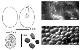  Seed, cotyledon, embryo, and testa:  A. laeta  (G. Bentham) R.C. Barneby & J.W. Grimes - top left cotyledons concealing radicle (L) and embryonic axis (R), bottom left seed topography, bottom left center seeds, testa SEMs.
