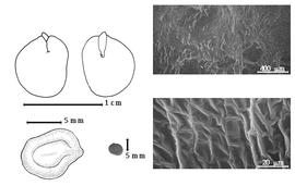  Seed, cotyledon, embryo, and testa:  A. patens  (W.J. Hooker & G.A.W. Arnott) J.P.M. Brenan - top left cotyledon concealing all but radicle tip (L) and embryonic axis (R), bottom left seed topography, bottom left center seed, testa SEMs.
