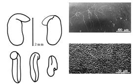  Cotyledon, embryo, and testa:  A. maurorum  F.K. Medikus - embryo, cotyledons, and testa SEMs.
