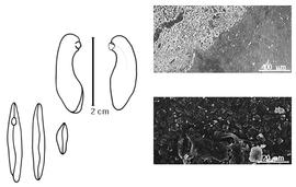  Cotyledon, embryo, and testa:  A. pterocarpoides  H.A.T. Harms - embryo, cotyledons, and testa SEMs.
